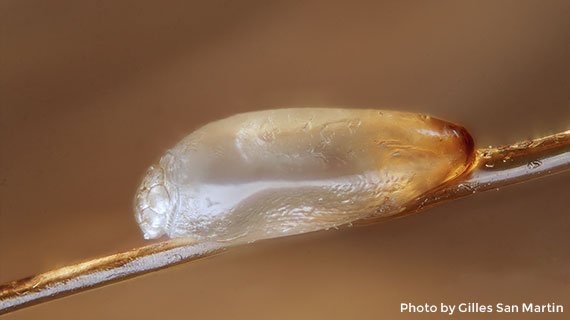 Lice Clinics Long Island - Close-up view of a louse egg on hair shaft